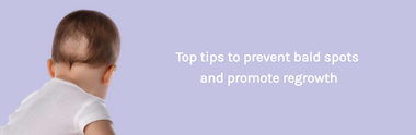Top Tips To Prevent Baby Bald Spots And Promote Hair Regrowth
