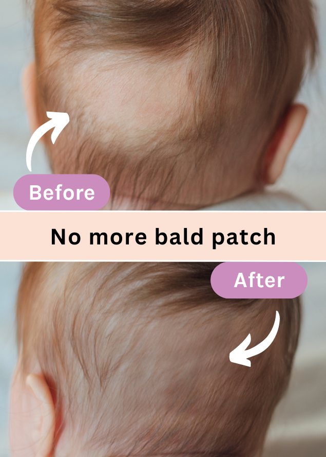 Prevent hair loss
